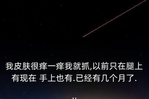 什么農藥殘留在手上癢,手上的農藥殘留可以用水沖掉嗎